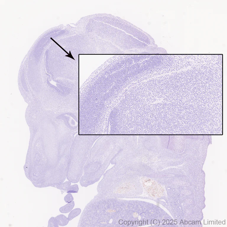 Immunohistochemistry (Formalin/PFA-fixed paraffin-embedded sections) - Anti-TUBA8 antibody [EPR30576-548] (AB325930)