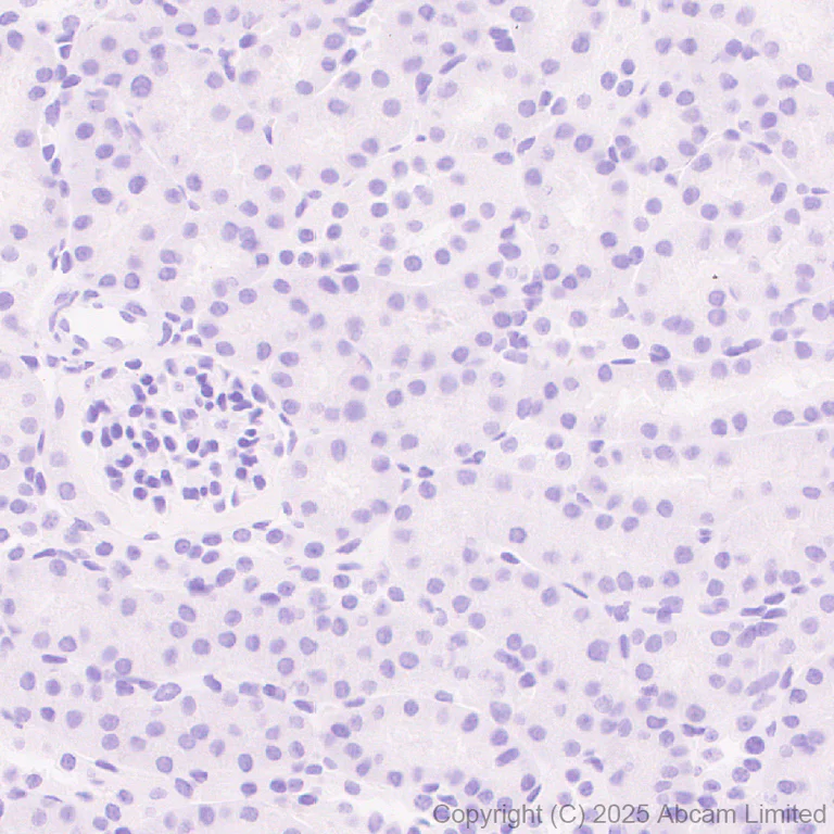 Immunohistochemistry (Formalin/PFA-fixed paraffin-embedded sections) - Anti-TUBA8 antibody [EPR30576-548] (AB325930)