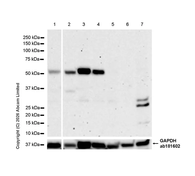 Western blot - Anti-TUBA8 antibody [EPR30576-548] (AB325930)