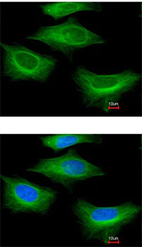 Immunocytochemistry/ Immunofluorescence - Anti-TUBB2A + TUBB2B antibody (AB155311)