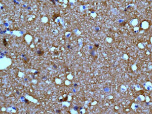 Immunohistochemistry (Formalin/PFA-fixed paraffin-embedded sections) - Anti-TUBB2A+TUBB2B antibody [EPR11843] - BSA and Azide free (AB249602), expandable thumbnail