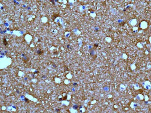Immunohistochemistry (Formalin/PFA-fixed paraffin-embedded sections) - Anti-TUBB2A+TUBB2B antibody [EPR11843] - BSA and Azide free (AB249602)