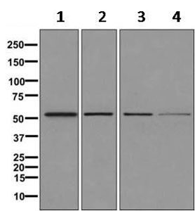 Western blot - Anti-TUBB2A+TUBB2B antibody [EPR11843] - BSA and Azide free (AB249602), expandable thumbnail