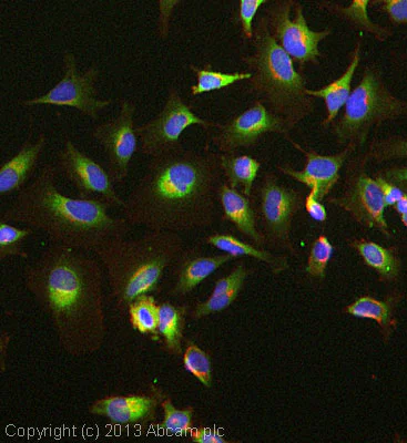 Immunocytochemistry/ Immunofluorescence - Anti-Tuberin antibody [EP1107Y] (AB52936)
