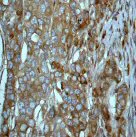 Immunohistochemistry (Formalin/PFA-fixed paraffin-embedded sections) - Anti-Tuberin antibody [EP1107Y] (AB52936)