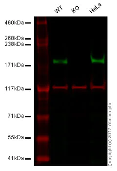 Western blot - Anti-Tuberin antibody [EP1107Y] (AB52936)