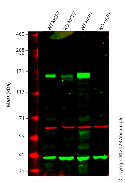 Western blot - Anti-Tuberin antibody [EP1107Y] (AB52936)