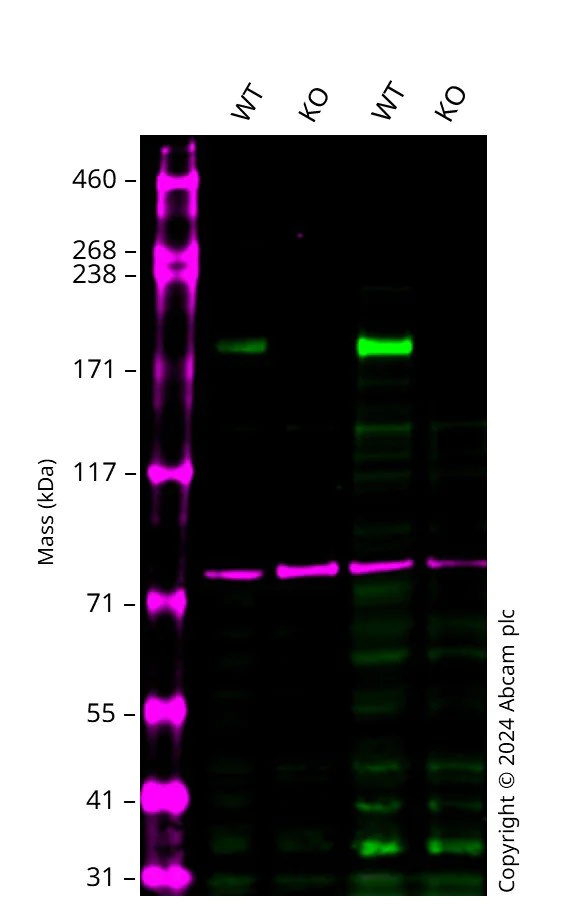 Western blot - Anti-Tuberin antibody [EP1107Y] (AB52936)