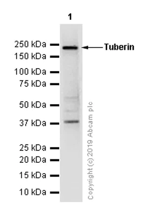 Western blot - Anti-Tuberin antibody [EP1107Y] (AB52936)