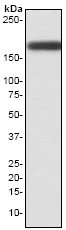 Western blot - Anti-Tuberin antibody [EP1107Y] (AB52936)
