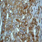 Immunohistochemistry (Formalin/PFA-fixed paraffin-embedded sections) - Anti-Tuberin antibody [EP1107Y] - BSA and Azide free (ab247339), expandable thumbnail