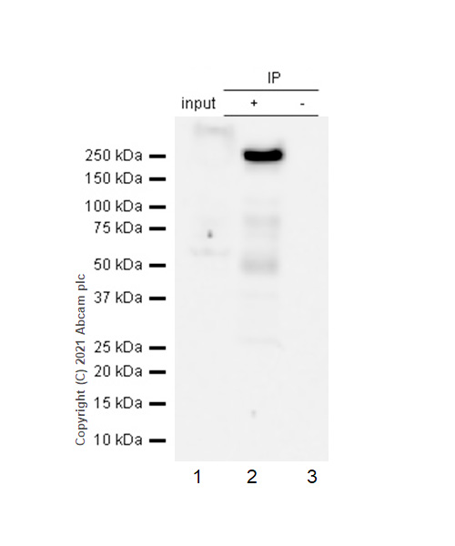 Immunoprecipitation - Anti-Tuberin antibody [EP1107Y] - BSA and Azide free (AB247339), expandable thumbnail