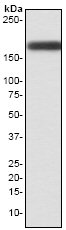 Western blot - Anti-Tuberin antibody [EP1107Y] - BSA and Azide free (ab247339), expandable thumbnail