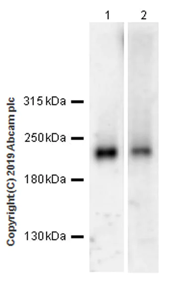 Western blot - Anti-Tuberin antibody [EPR22886-235] (AB255612)