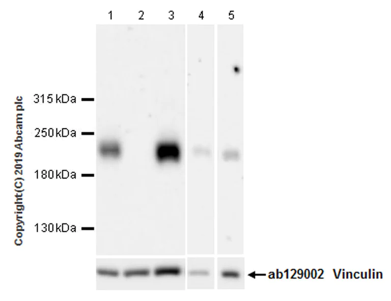Western blot - Anti-Tuberin antibody [EPR22886-235] - BSA and Azide free (AB256472)