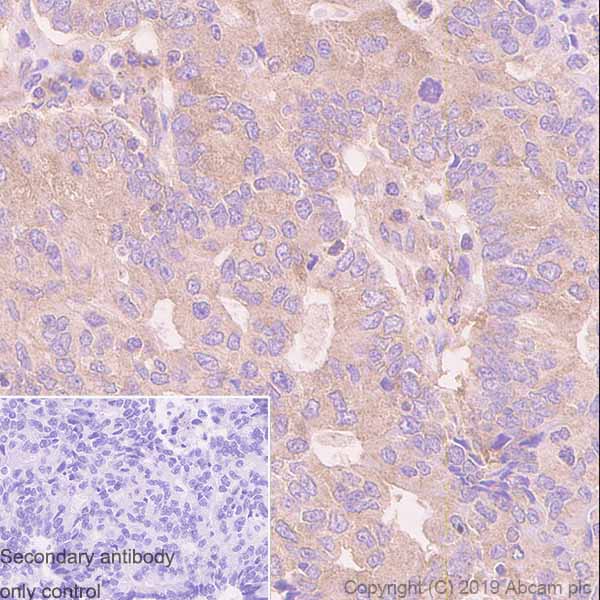 Immunohistochemistry (Formalin/PFA-fixed paraffin-embedded sections) - Anti-Tuberin antibody [Y320] (AB32554), expandable thumbnail