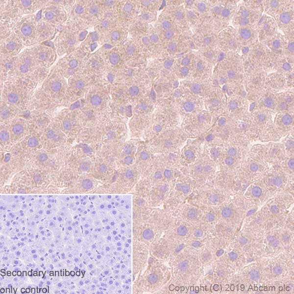 Immunohistochemistry (Formalin/PFA-fixed paraffin-embedded sections) - Anti-Tuberin antibody [Y320] (AB32554), expandable thumbnail