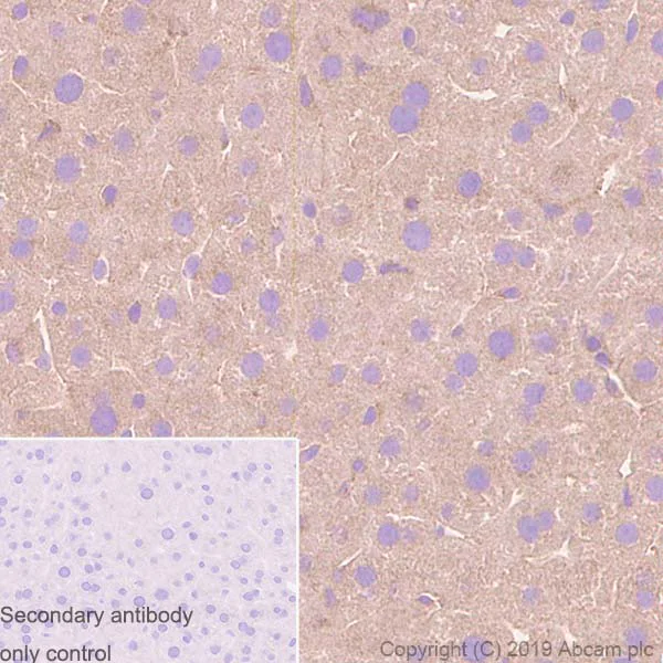 Immunohistochemistry (Formalin/PFA-fixed paraffin-embedded sections) - Anti-Tuberin antibody [Y320] (AB32554)