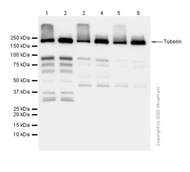 Western blot - Anti-Tuberin antibody [Y320] (AB32554), expandable thumbnail