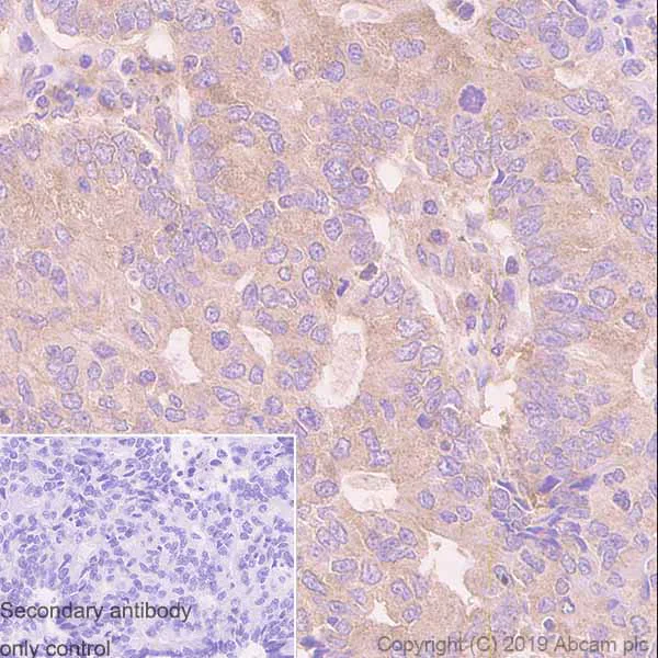 Immunohistochemistry (Formalin/PFA-fixed paraffin-embedded sections) - Anti-Tuberin antibody [Y320] - BSA and Azide free (AB178441)