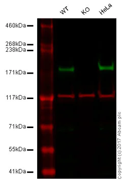 Western blot - Anti-Tuberin antibody [Y320] - BSA and Azide free (AB178441)