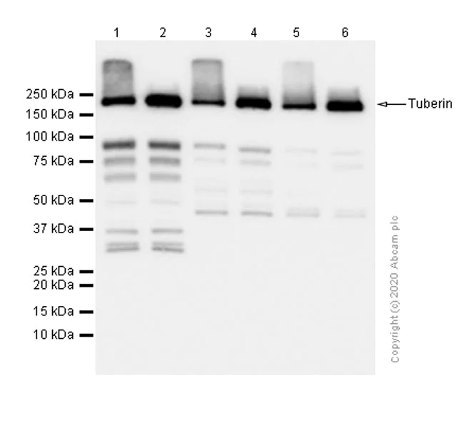 Western blot - Anti-Tuberin antibody [Y320] - BSA and Azide free (AB178441)