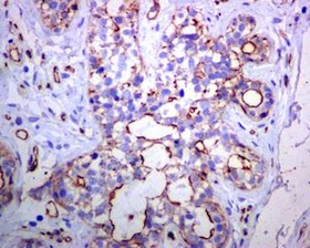 Immunohistochemistry (Formalin/PFA-fixed paraffin-embedded sections) - Anti-Tuberin (phospho S1254) antibody [EPR5682] (AB133454)