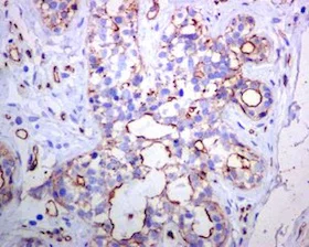 Immunohistochemistry (Formalin/PFA-fixed paraffin-embedded sections) - Anti-Tuberin (phospho S1254) antibody [EPR5682] (AB133454)