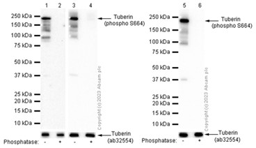 Western blot - Anti-Tuberin (phospho S664) antibody [EPR8202] (AB133465), expandable thumbnail