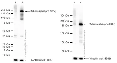 Western blot - Anti-Tuberin (phospho S664) antibody [EPR8202] - BSA and Azide free (AB248510)