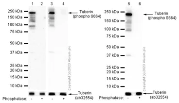 Western blot - Anti-Tuberin (phospho S664) antibody [EPR8202] - BSA and Azide free (AB248510)