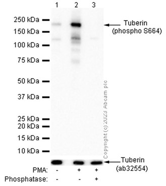 Western blot - Anti-Tuberin (phospho S664) antibody [EPR8202] - BSA and Azide free (AB248510)