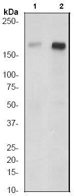Western blot - Anti-Tuberin (phospho S939) antibody [EP1062Y] - BSA and Azide free (AB247344)