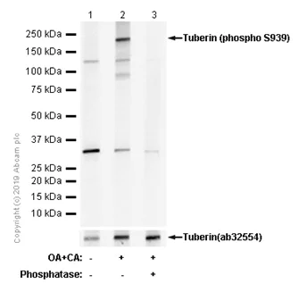 Western blot - Anti-Tuberin (phospho S939) antibody [EP1062Y] - BSA and Azide free (AB247344)
