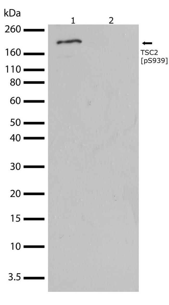 Western blot - Anti-Tuberin (phospho S939) antibody [RP23040080] (AB308037), expandable thumbnail