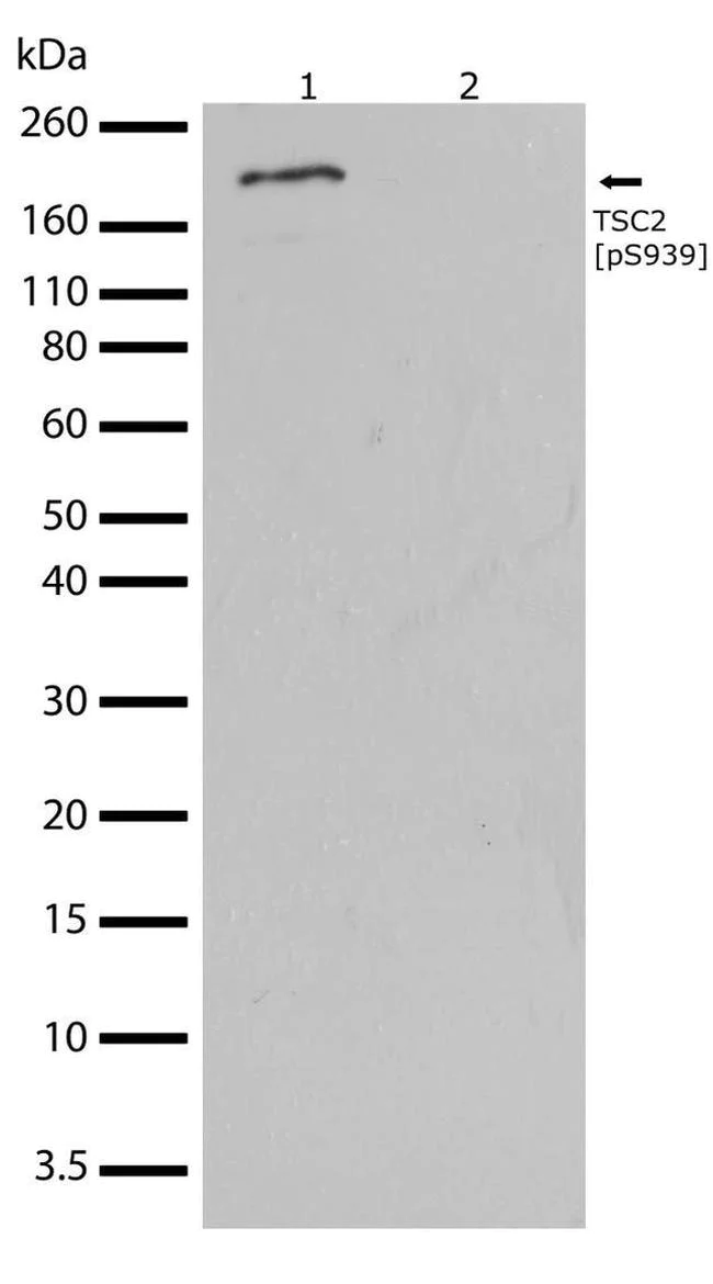 Western blot - Anti-Tuberin (phospho S939) antibody [RP23040080] (AB308037)