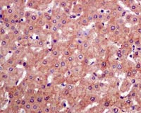 Immunohistochemistry (Formalin/PFA-fixed paraffin-embedded sections) - Anti-Tuberin (phospho T1462) antibody [EPR1060(2)] (AB109403)