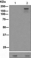 Western blot - Anti-Tuberin (phospho T1462) antibody [EPR1060(2)] (AB109403)