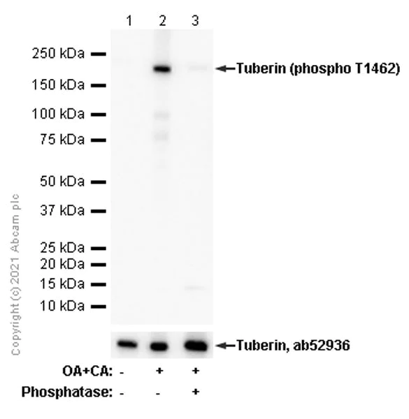 Western blot - Anti-Tuberin (phospho T1462) antibody [EPR1060(2)] - BSA and Azide free (AB247850)
