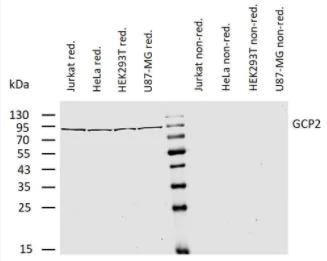 Western blot - Anti-TUBGCP2 antibody [GCP2-01] (AB140225)