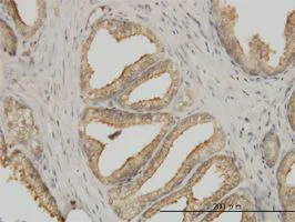 Immunohistochemistry (Formalin/PFA-fixed paraffin-embedded sections) - Anti-Tubulin antibody [4D1] - Loading Control (AB56676)