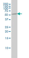 Western blot - Anti-Tubulin antibody [4D1] - Loading Control (AB56676)