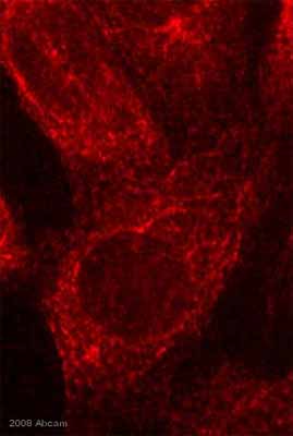 Immunocytochemistry/ Immunofluorescence - Anti-Tubulin antibody [YOL1/34] - Microtubule Marker (AB6161), expandable thumbnail