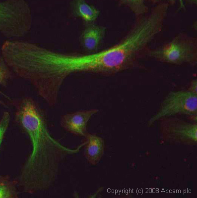 Immunocytochemistry/ Immunofluorescence - Anti-Tubulin antibody [YOL1/34] - Microtubule Marker (ab6161), expandable thumbnail