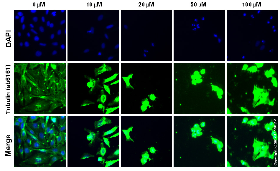 Immunocytochemistry/ Immunofluorescence - Anti-Tubulin antibody [YOL1/34] - Microtubule Marker (ab6161), expandable thumbnail