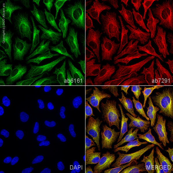 Immunocytochemistry/ Immunofluorescence - Anti-Tubulin antibody [YOL1/34] - Microtubule Marker (AB6161), expandable thumbnail