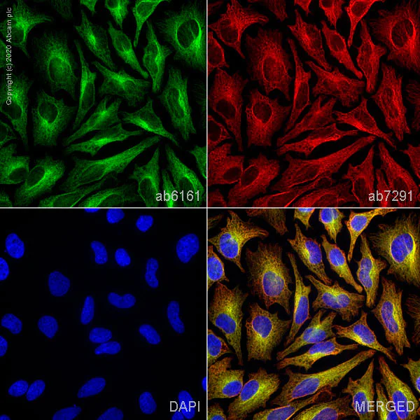 Immunocytochemistry/ Immunofluorescence - Anti-Tubulin antibody [YOL1/34] - Loading Control (AB6161)