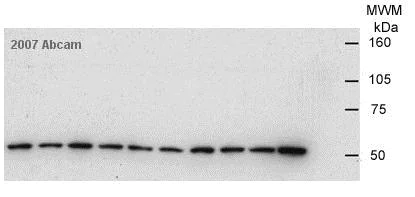 Western blot - Anti-Tubulin antibody [YOL1/34] - Loading Control (AB6161)