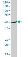 Western blot - Anti-TUFM antibody (AB67991), expandable thumbnail