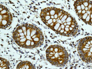 Immunohistochemistry (Formalin/PFA-fixed paraffin-embedded sections) - Anti-TUFM antibody [EPR12797(B)] (AB173300), expandable thumbnail